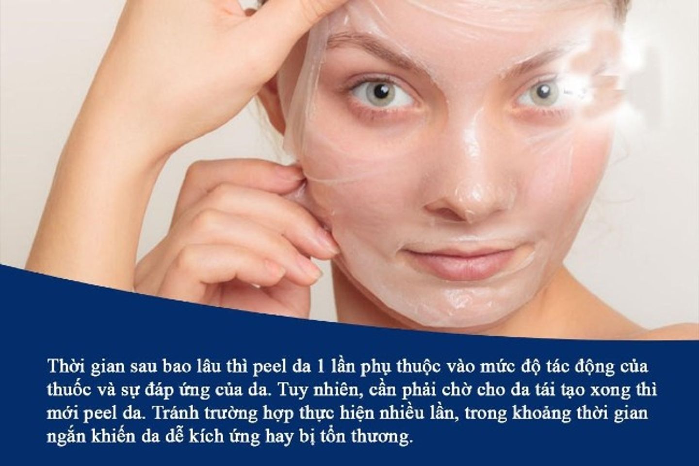 N&ecirc;n peel da khoảng 10 ng&agrave;y/ 1 lần đối với da &iacute;t khuyết điểm v&agrave; l&acirc;u hơn nếu da nhiều vấn đề