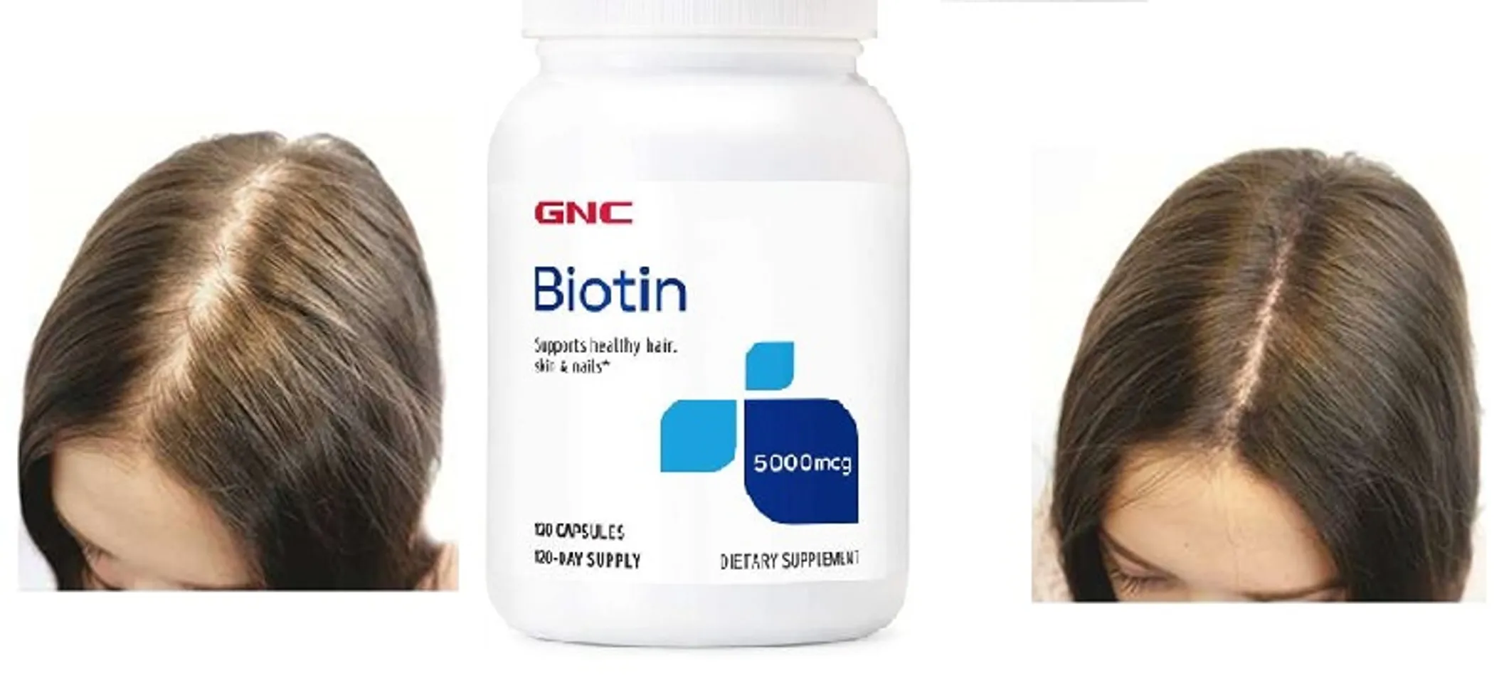 Viên uống hỗ trợ mọc tóc GNC Biotin 5000mcg cải thiện gãy rụng, giúp tắc dày, chắc khỏe
