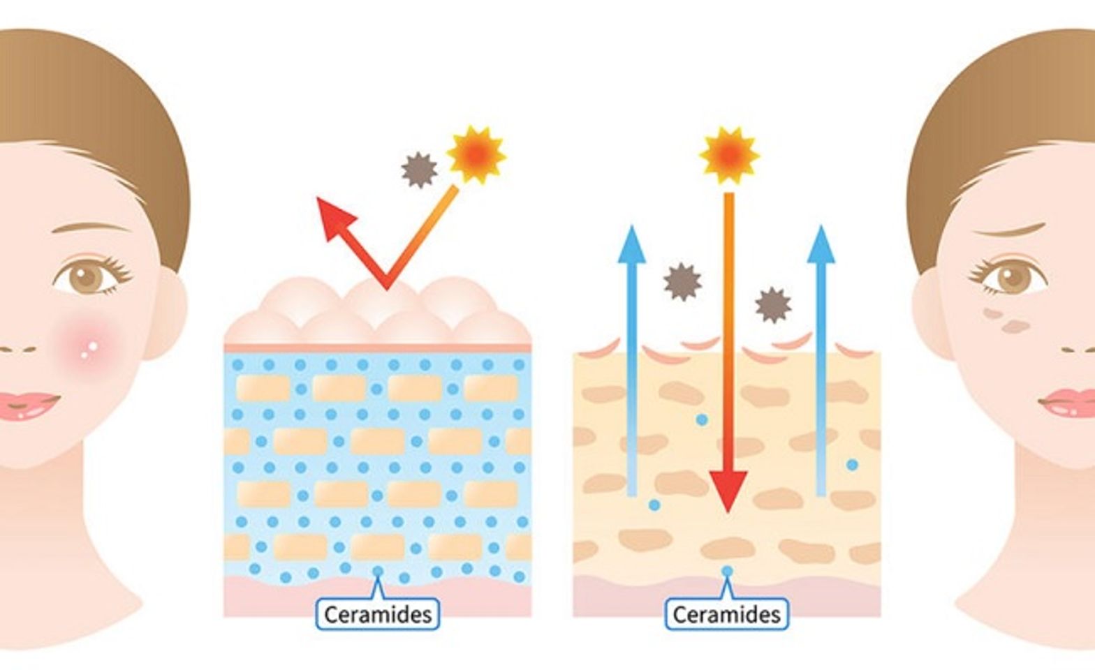 Ceramides là gì trong chăm sóc da? Tác dụng và cách sử dụng Ceramides