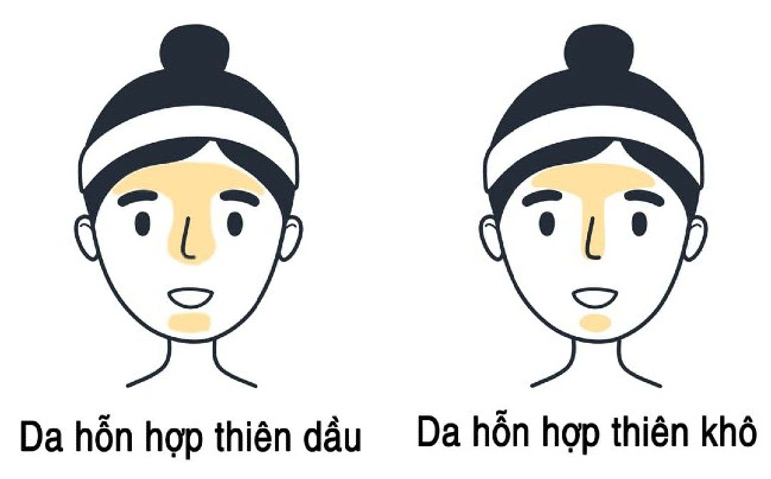 C&aacute;ch x&aacute;c định da hỗn hợp thi&ecirc;n dầu v&agrave; da hỗn hợp thi&ecirc;n kh&ocirc;