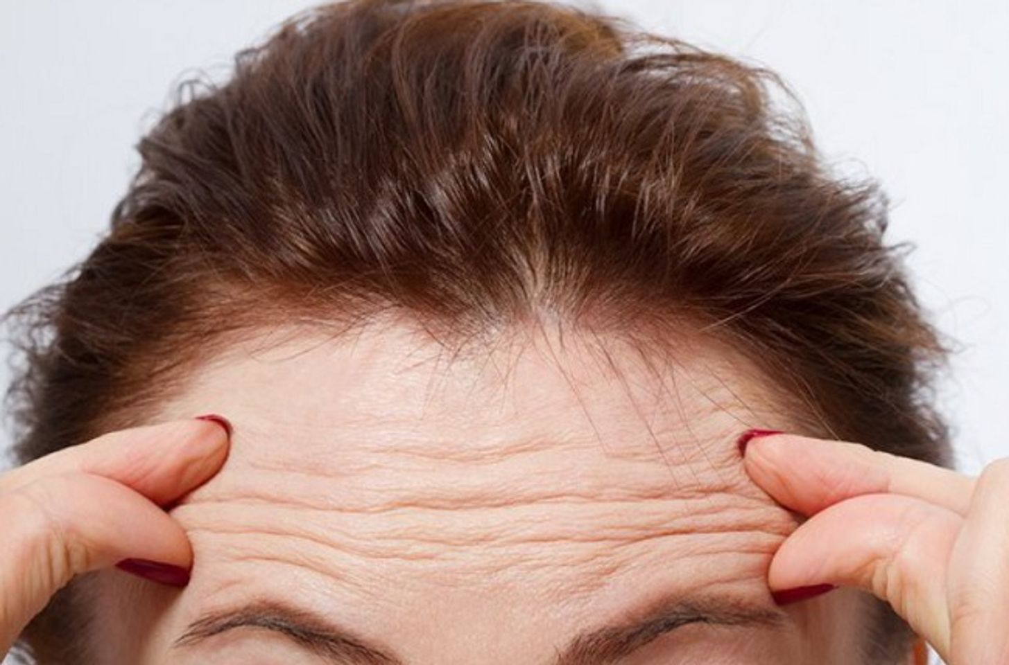 ưu &dstrok;iểm của lactic acid gi&uacute;p giảm nếp nhăn v&agrave; đường nhăn tr&ecirc;n da