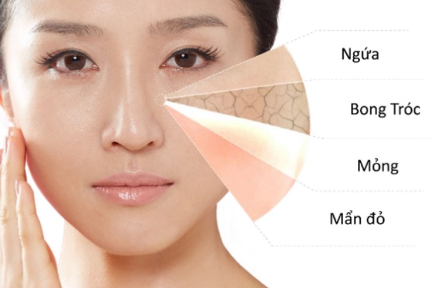 T&igrave;nh trạng da nhạy cảm