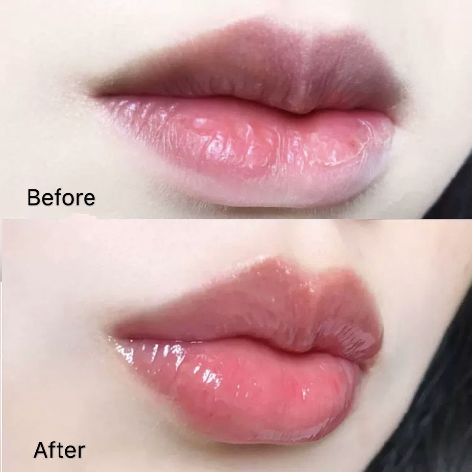 Son dưỡng môi Benefiance Full Correction Lip Treatment hỗ trợ môi căng bóng, hồng hào