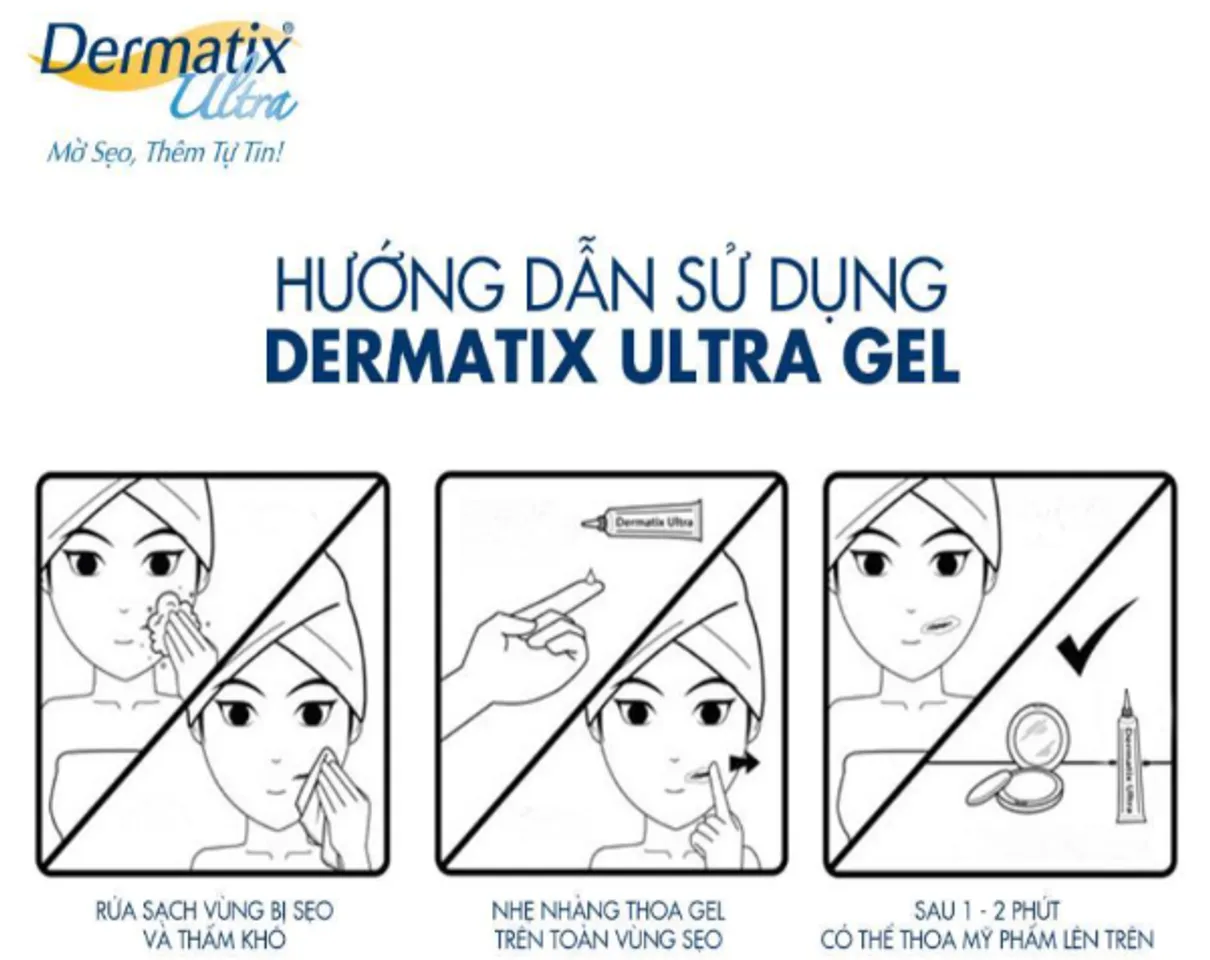 Hướng dẫn sử dụng Dermatix Ultra Gel 