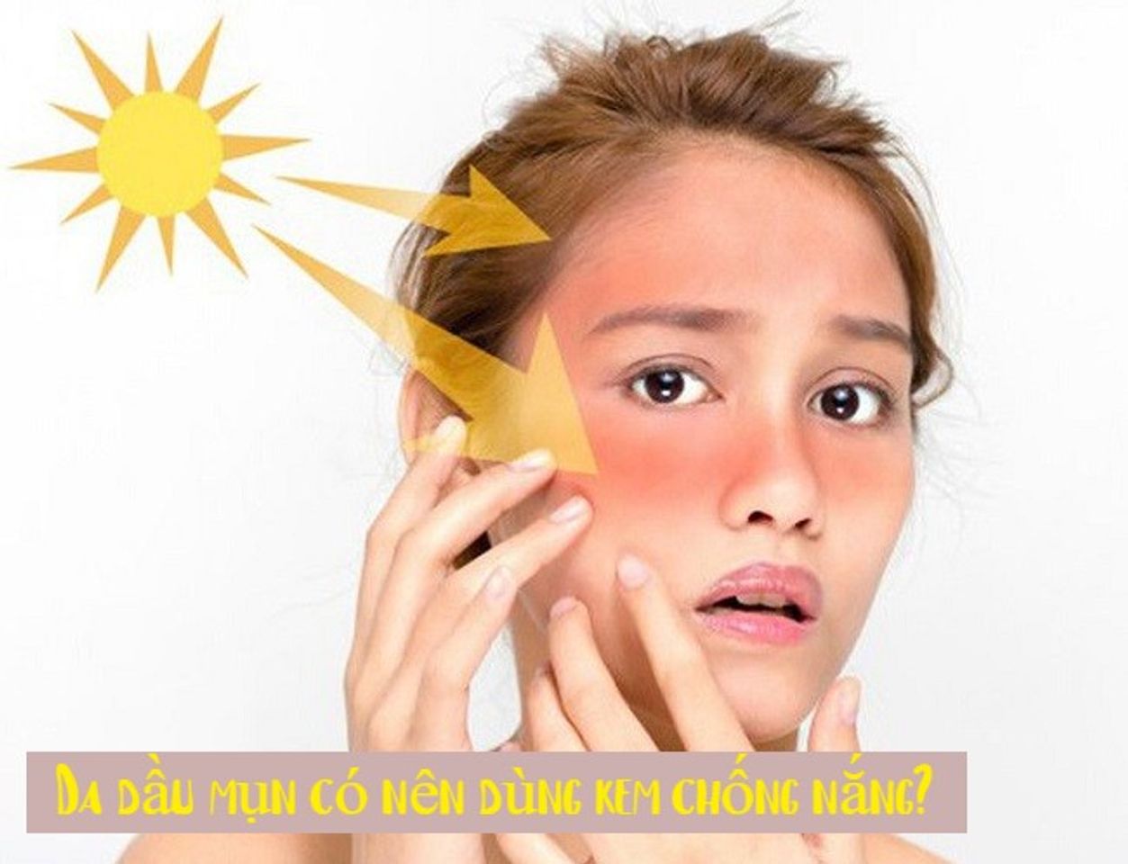 Da dầu mụn có nên dùng kem chống nắng