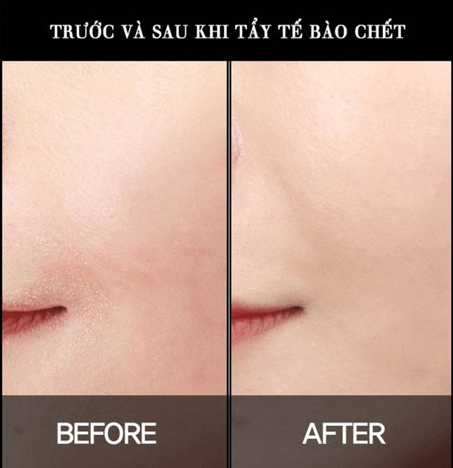 ưu điểm của sữa rửa mặt tẩy tế b&agrave;o chết l&agrave; gi&uacute;p da mịn v&agrave; giảm sự đổi m&agrave;u