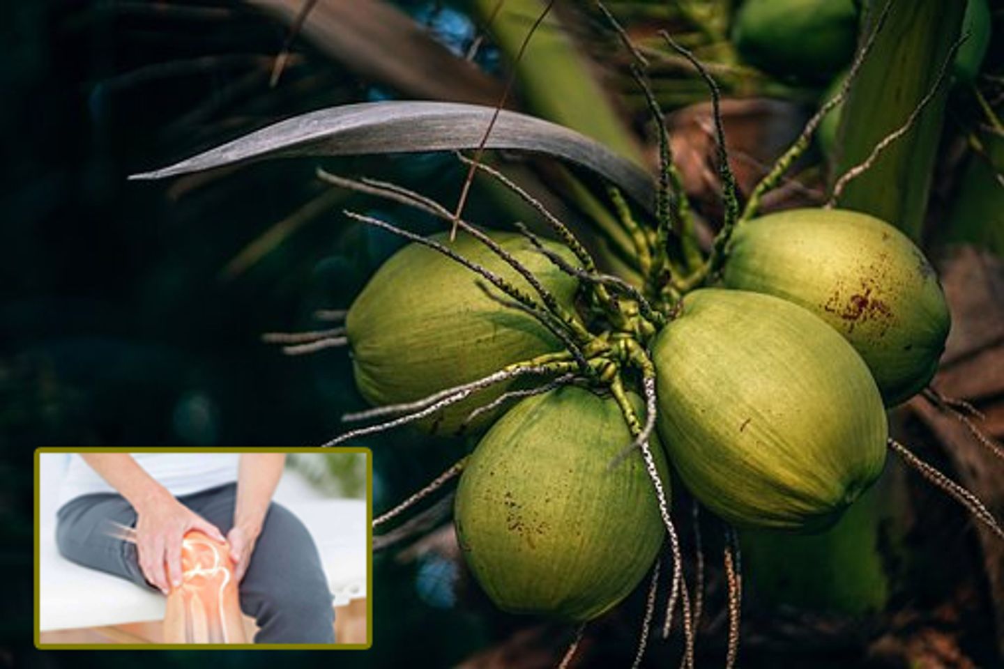 Uống nước dừa c&oacute; tốt cho xương khớp kh&ocirc;ng?