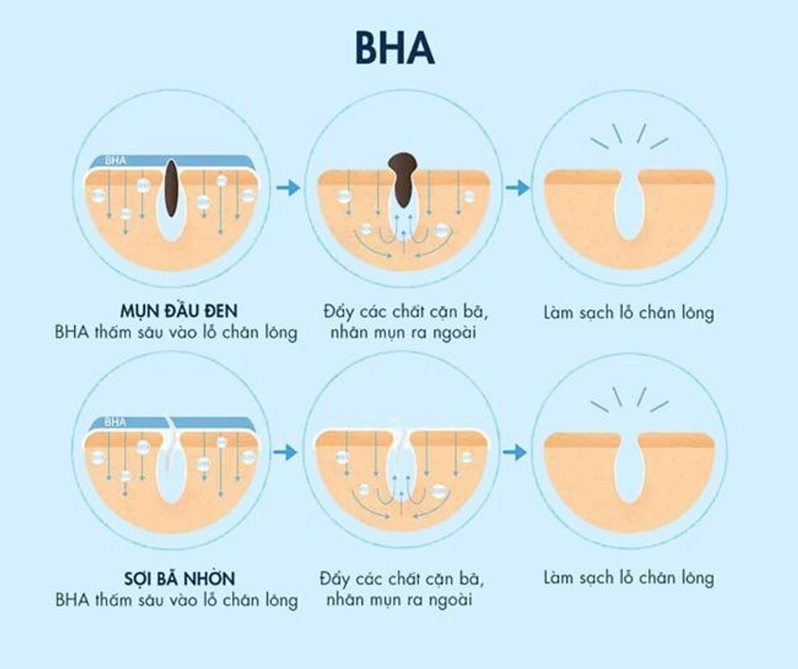 C&aacute;c loại treatment - BHA