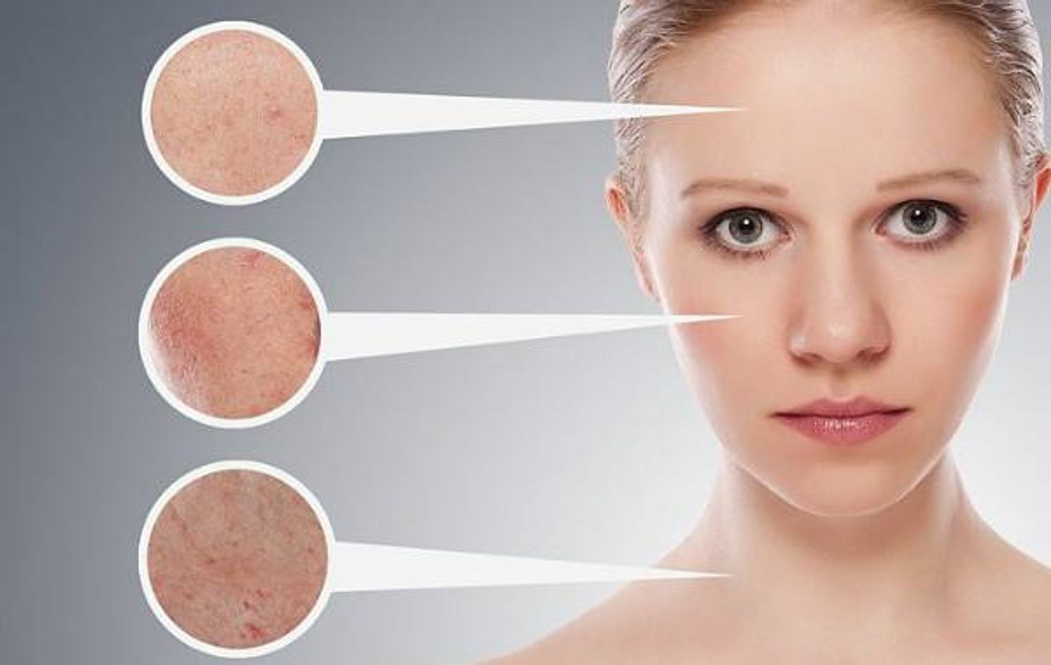 Tẩy tế b&agrave;o chết BHA c&oacute; gi&uacute;p l&agrave;m sạch mụn kh&ocirc;ng?