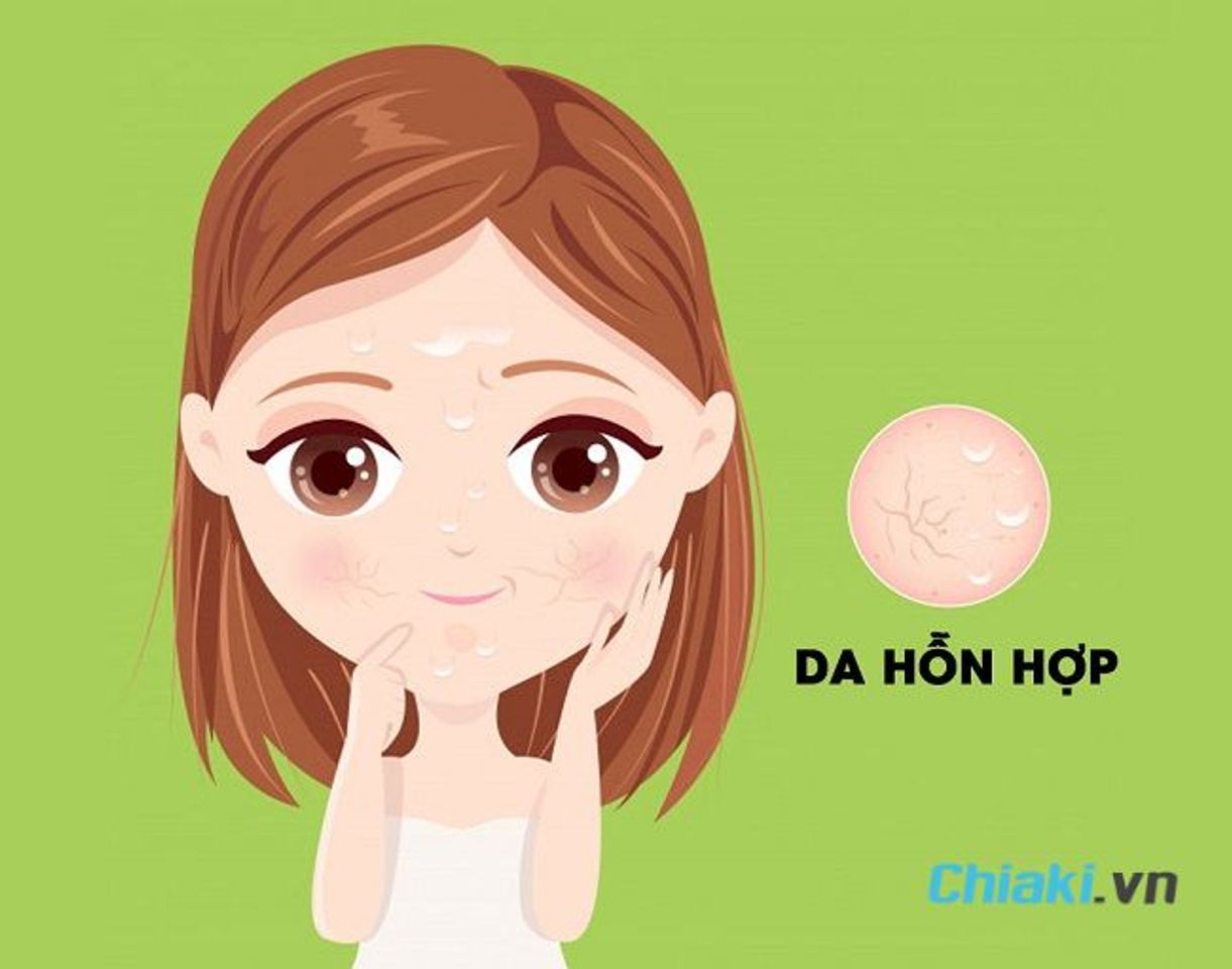 Da hỗn hợp l&agrave; g&igrave;
