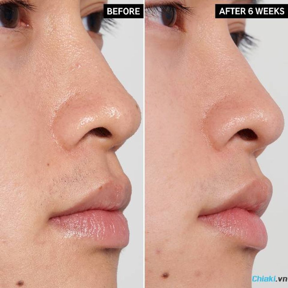 ưu &dstrok;iểm của toner dưỡng trắng da&nbsp;