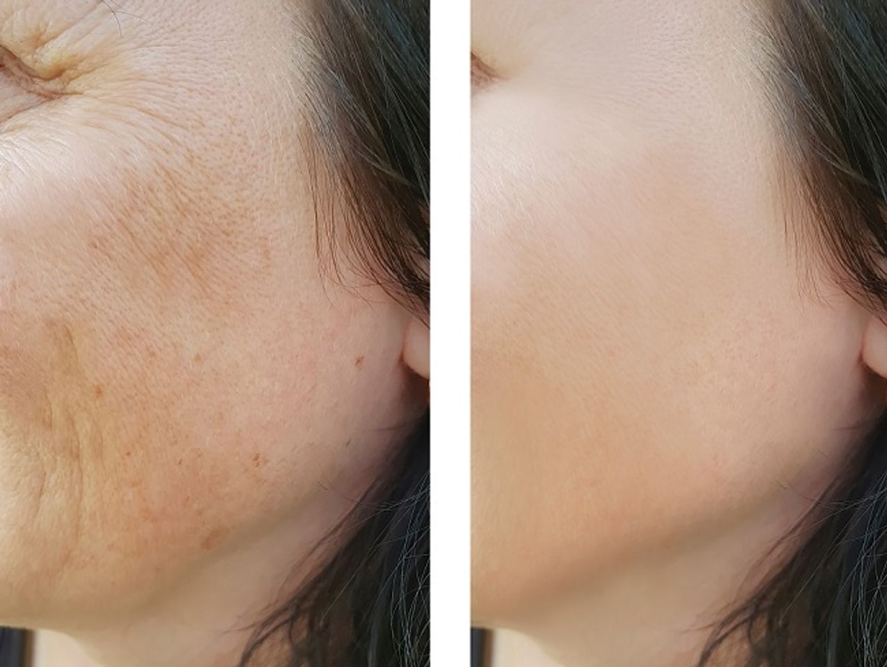C&ocirc;ng nghệ dược phẩm sinh học trong điều trị n&aacute;m