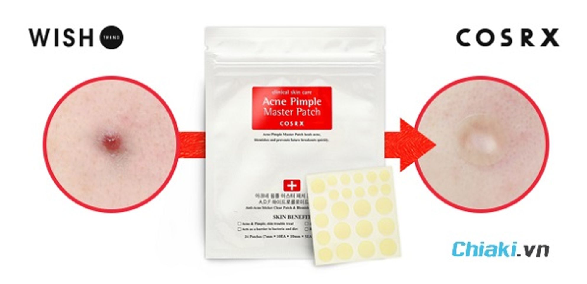 Kinh nghiệm chọn mua miếng d&aacute;n mụn ph&ugrave; hợp