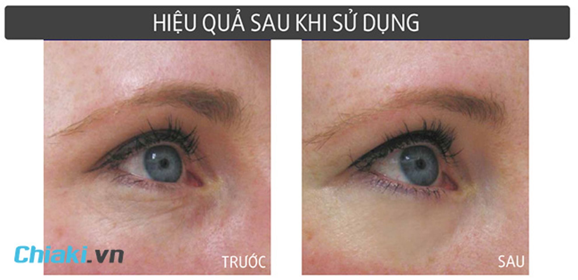 Kem mắt của Nhật cho hiệu quả cao