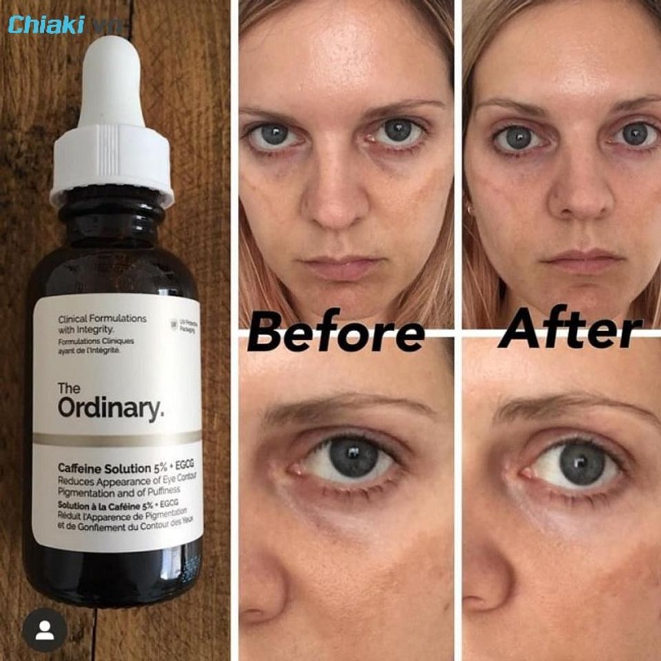ưu điểm Serum Ordinary Caffeine Solution 5% + EGCG