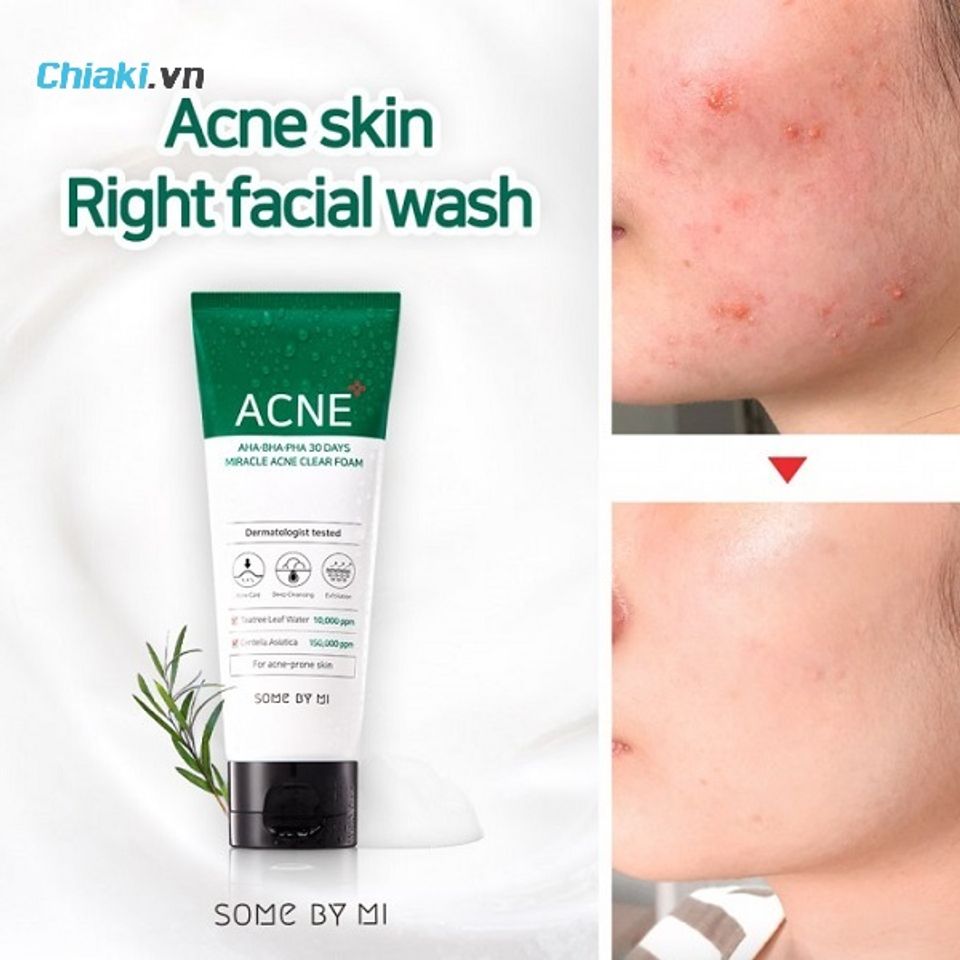 Some By Mi AHA-BHA-PHA 30 Days Miracle Acne Clear Foam