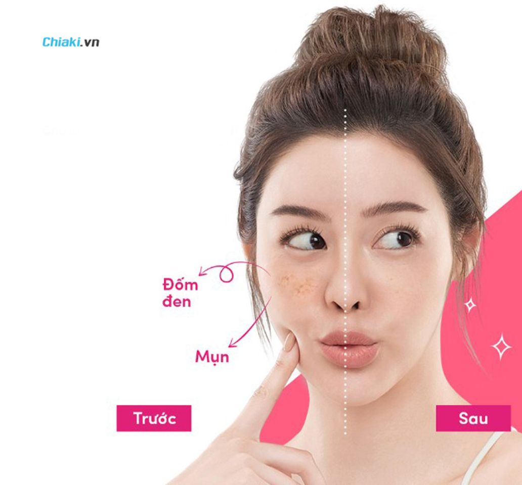Lời khuy&ecirc;n d&agrave;nh cho bạn khi muốn dưỡng trắng da l&agrave;nh t&iacute;nh