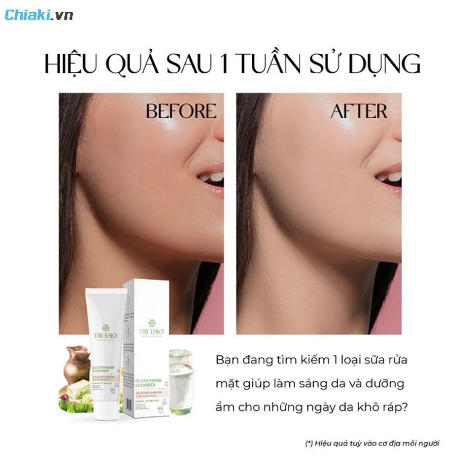 Sữa rửa mặt Truesky c&oacute; ưu điểm dưỡng ẩm v&agrave; l&agrave;m s&aacute;ng da