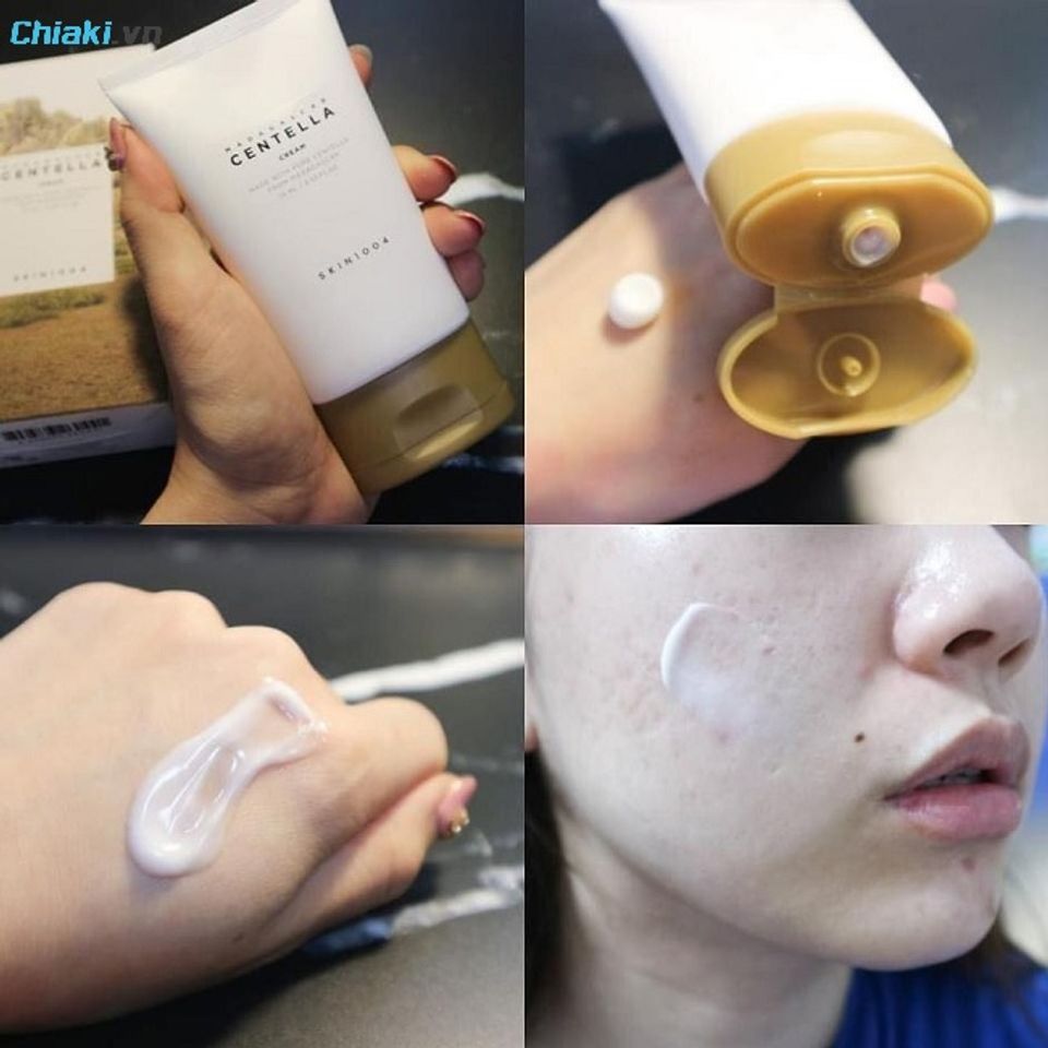 Kem dưỡng Centella cho da dầu mụn Madagascar Skin1004 kết cấu kem mỏng