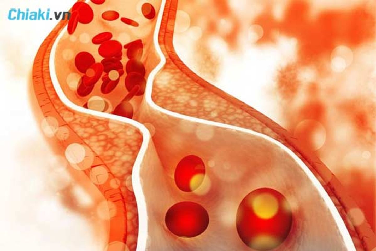 Fucoidan xanh Okinawa giảm cholesterol trong m&aacute;u