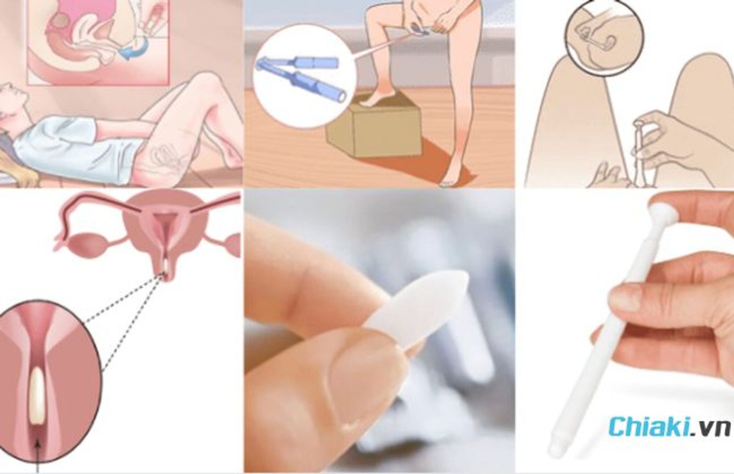 C&aacute;ch sử dụng vi&ecirc;n đặt phụ khoa trị nấm ngứa&nbsp;
