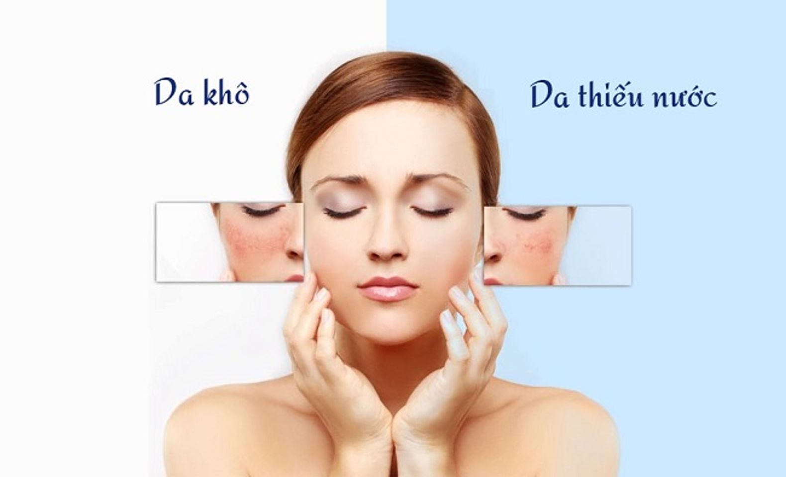 C&aacute;ch nhận biết l&agrave;n da bị kh&ocirc;