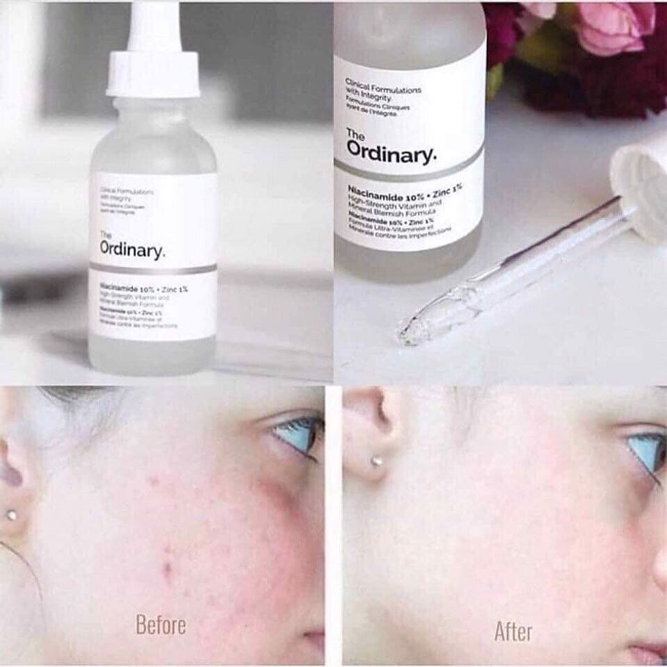 Serum The Ordinary Niacinamide 10% + Zinc 1% chống vi&ecirc;m