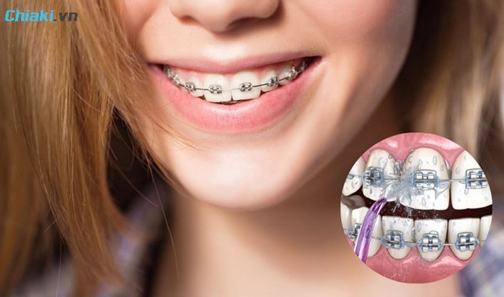 Sử dụng kết hợp th&ecirc;m m&aacute;y tăm nước để l&agrave;m sạch mảng b&aacute;m hiệu quả