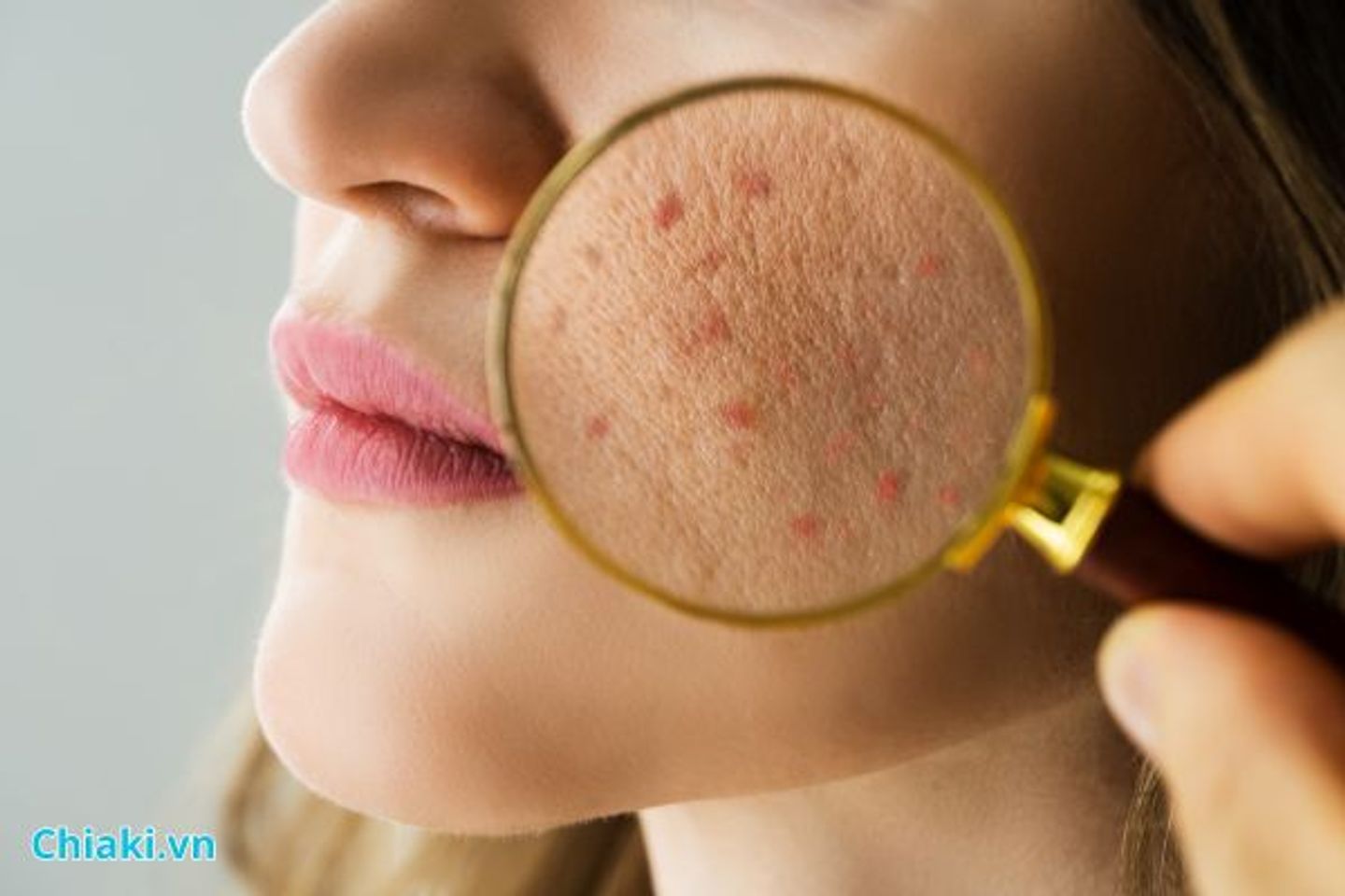 Mặt mụn c&oacute; n&ecirc;n d&ugrave;ng m&aacute;y rửa mặt kh&ocirc;ng?