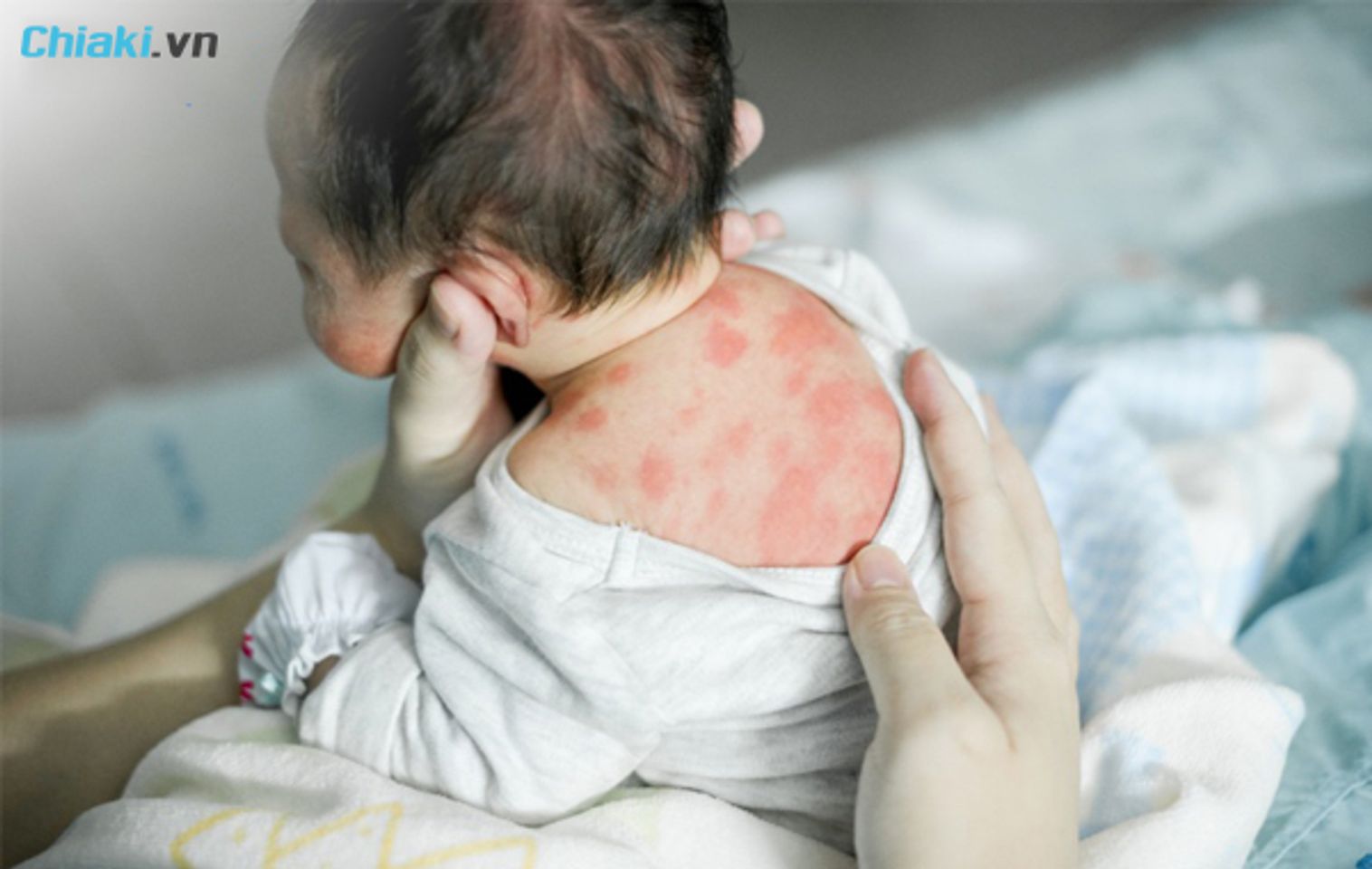 N&ecirc;n đổi sữa khi trẻ bị ti&ecirc;u chảy, buồn n&ocirc;n v&agrave; nổi ban