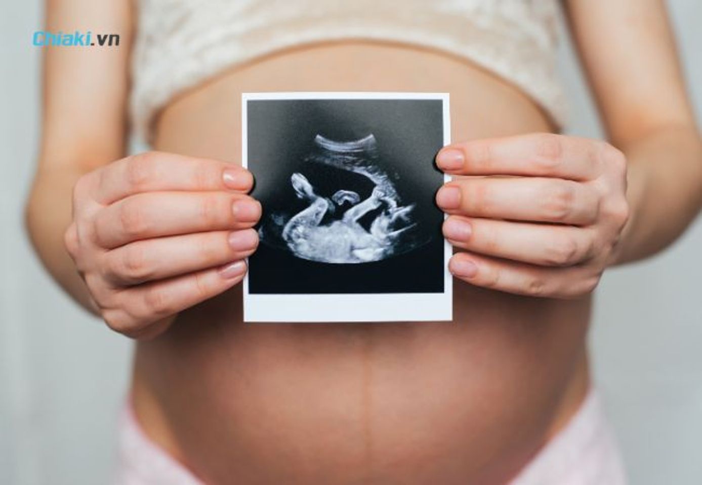 Dư nước ối l&agrave; lượng nước ối trong b&agrave;o thai vượt cao hơn ti&ecirc;u chuẩn