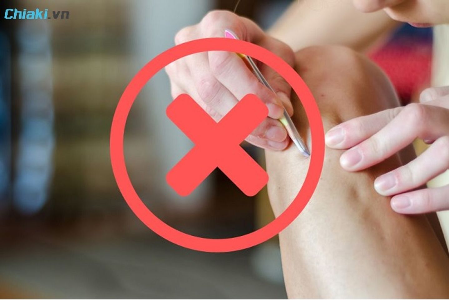 Kh&ocirc;ng wax, cạo hay nhổ l&ocirc;ng sau khi triệt l&ocirc;ng