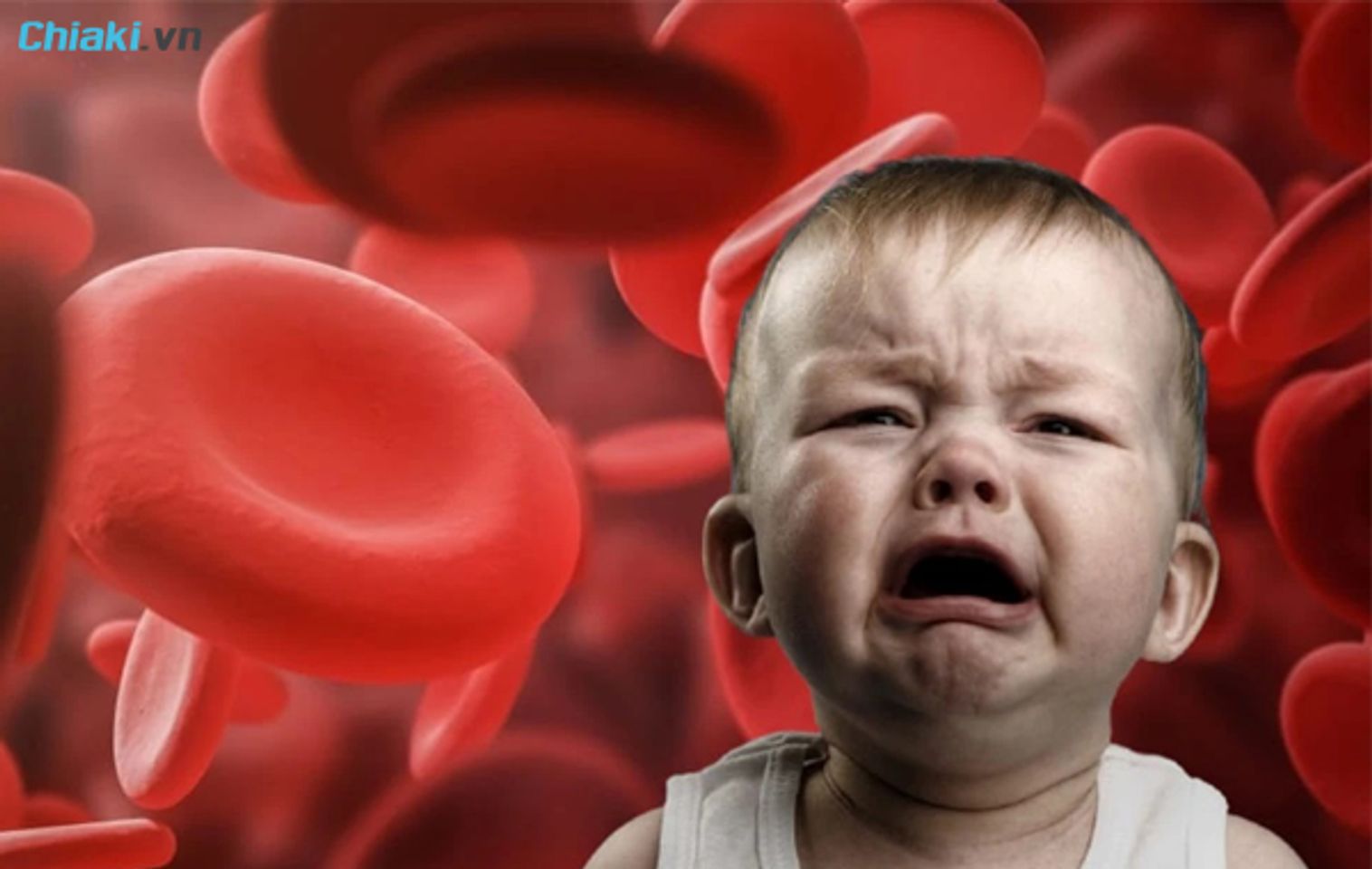 c&aacute;c dấu hiệu khi trẻ bị thiếu m&aacute;u