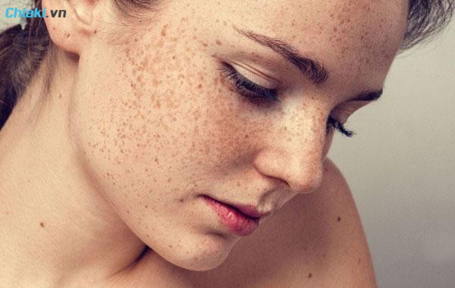 c&oacute; rất nhiều nguy&ecirc;n nh&acirc;n khiến da bị đồi mồi