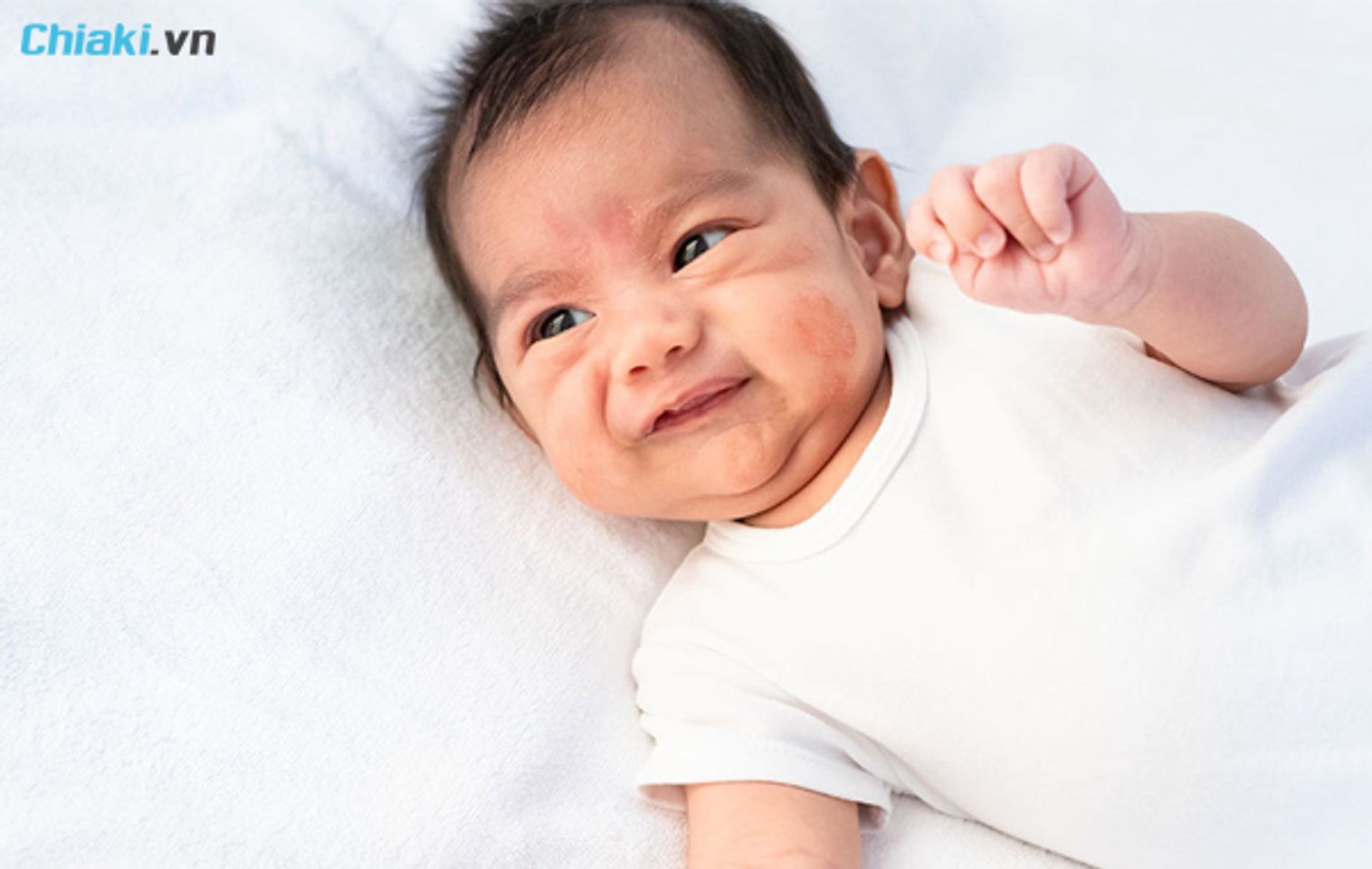 ch&agrave;m sữa ở trẻ sơ sinh g&acirc;y t&igrave;nh trạng ngứa ng&aacute;y kh&oacute; chịu