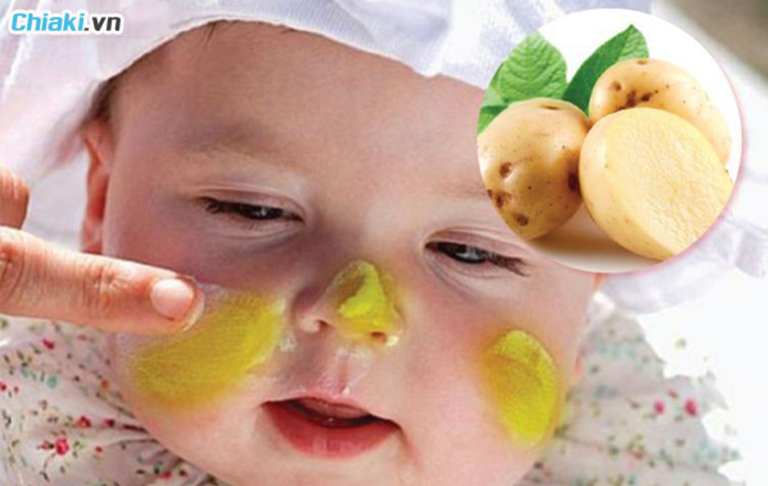 những lưu &yacute; khi &aacute;p dụng mẹo d&acirc;n gian chữa ch&agrave;m sữa cho trẻ sơ sinh 
