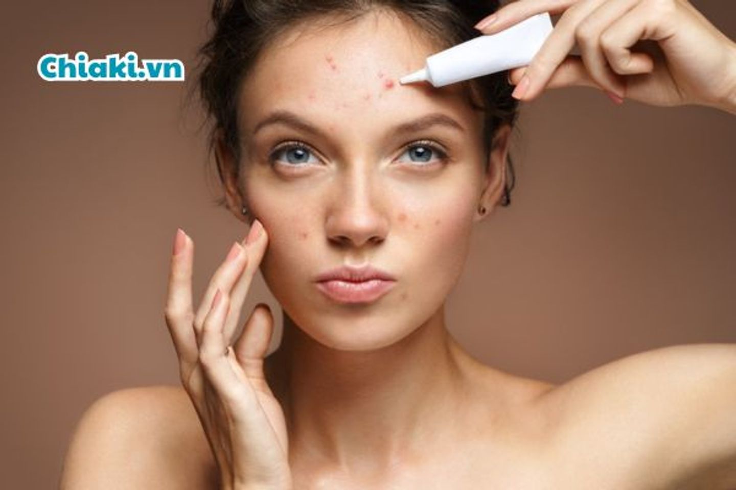 C&aacute;ch chọn kem trị mụn đầu đen hiệu quả
