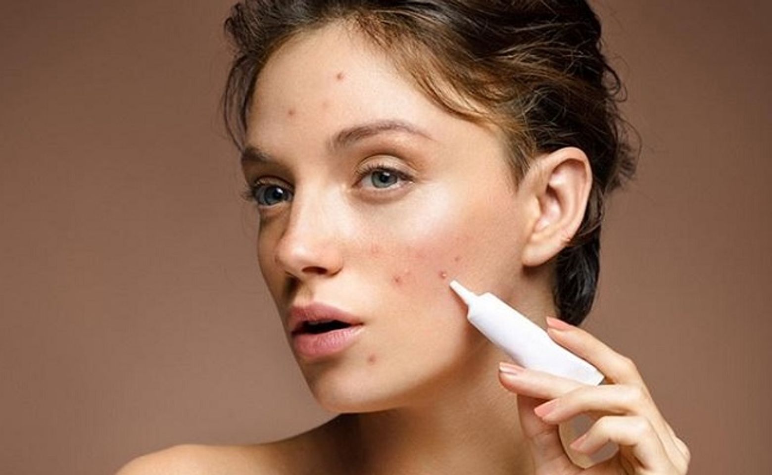 Cách sử dụng gel trị mụn 