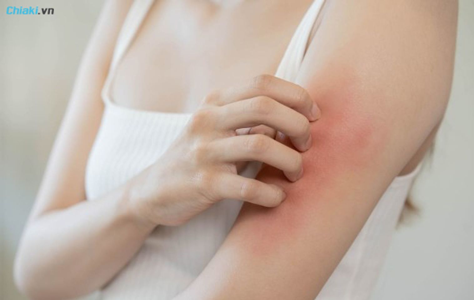 Nguy&ecirc;n nh&acirc;n bị hăm da ở người lớn