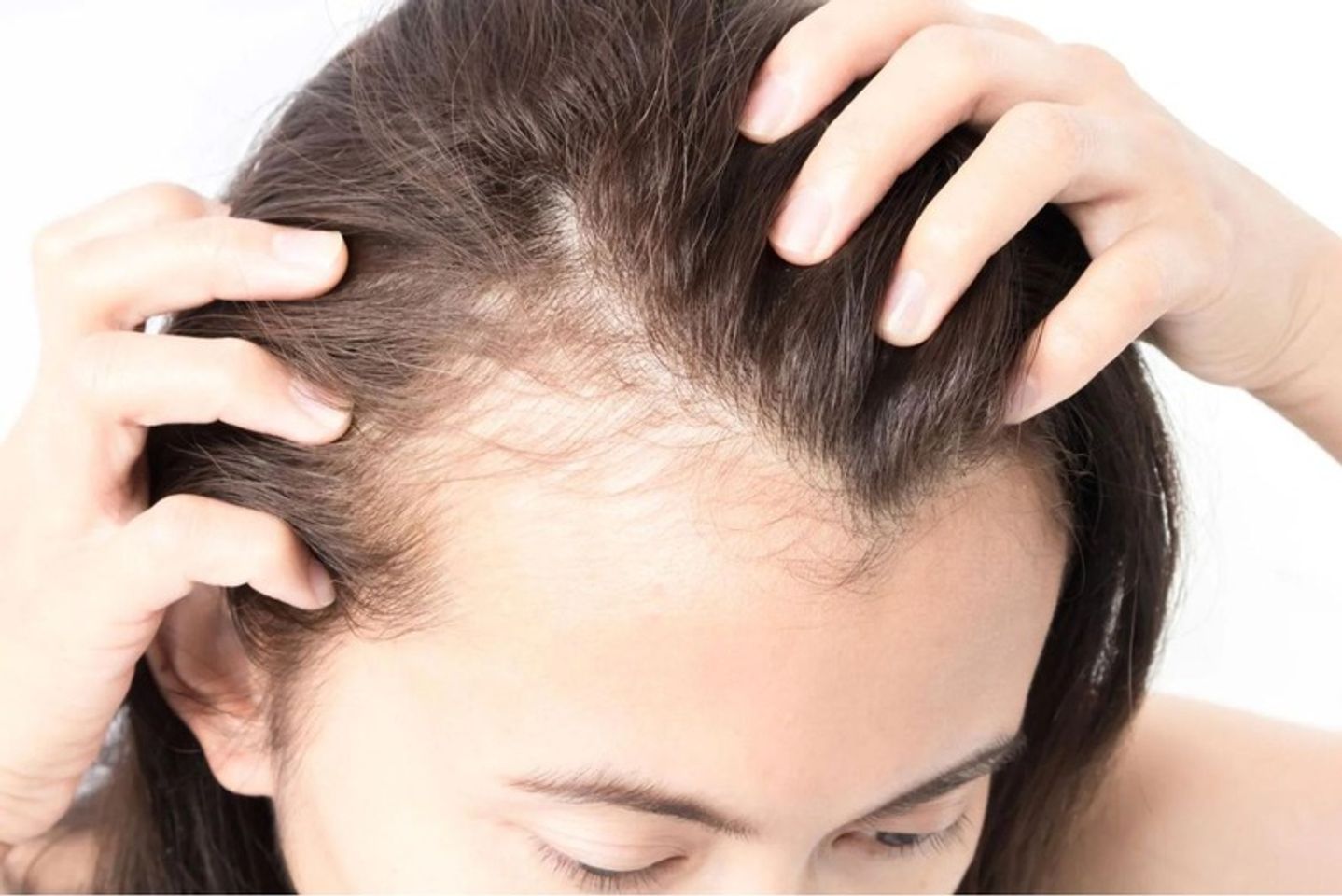 Tại sao t&oacute;c bị mọc chậm v&agrave; dễ rụng?