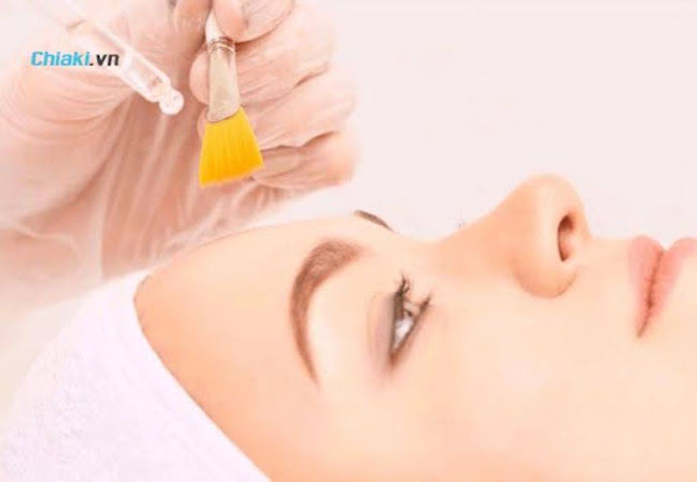 C&aacute;c trường hợp n&ecirc;n v&agrave; kh&ocirc;ng n&ecirc;n thực hiện peel da trị mụn