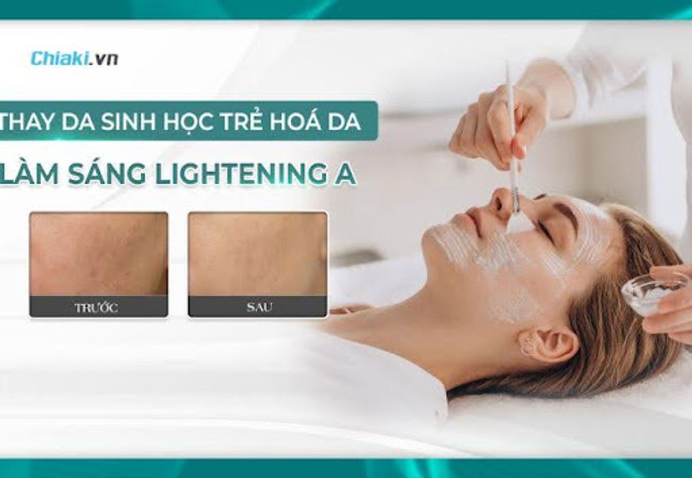 Da sẽ gặp phản ứng g&igrave; nếu peel da trị mụn sai c&aacute;ch?