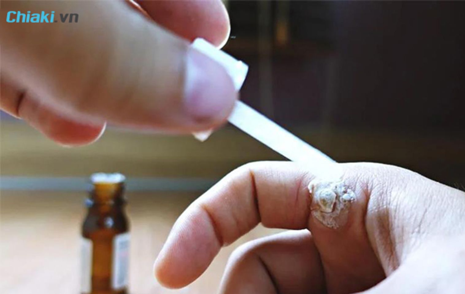 Những lưu &yacute; khi d&ugrave;ng thuốc trị mụn c&oacute;c