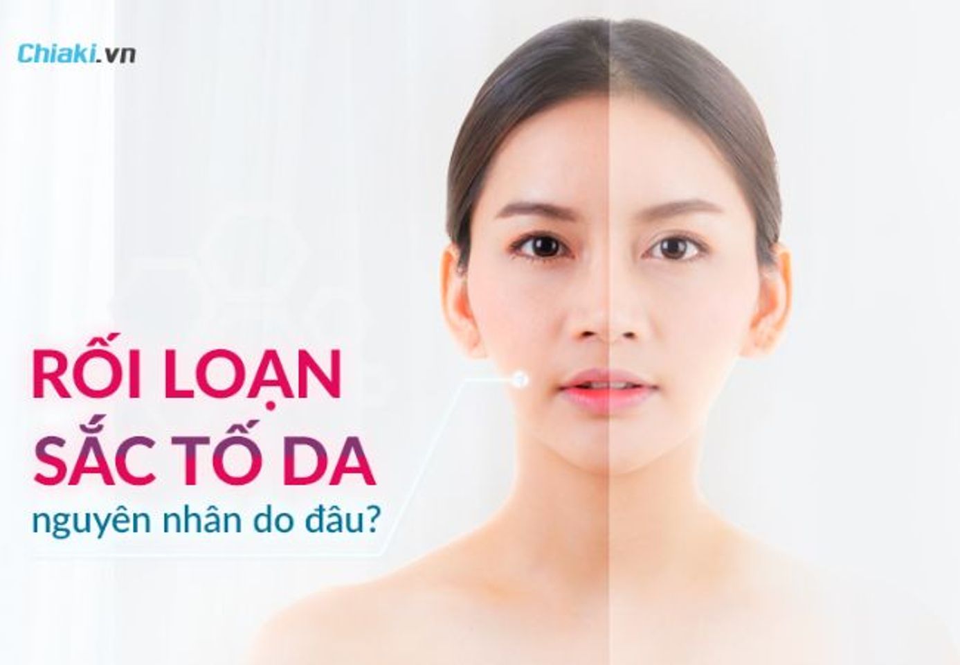Rối loạn sắc tố melanin g&acirc;y hại g&igrave; cho sức khỏe của l&agrave;n da?