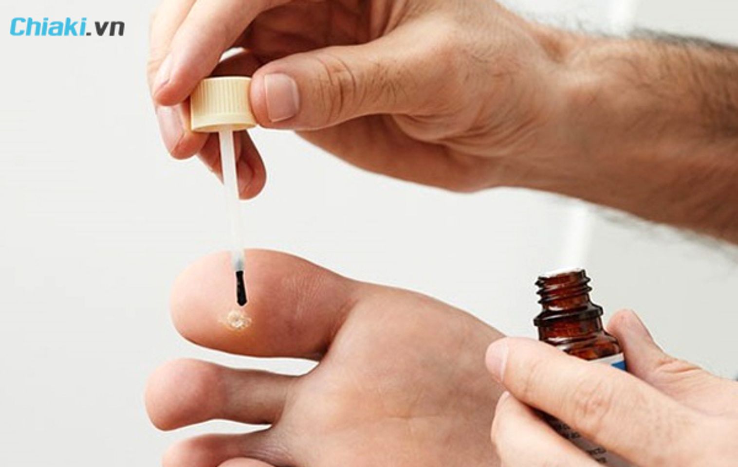 Ti&ecirc;u ch&iacute; lựa chọn thuốc trị mụn c&oacute;c ph&ugrave; hợp