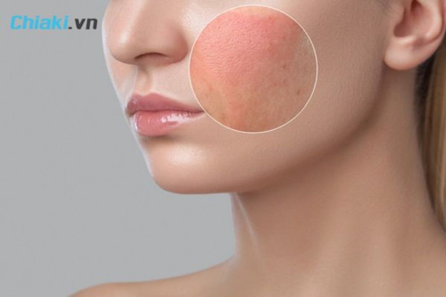 C&aacute;c vấn đề gặp phải sau khi t&aacute;i tạo da