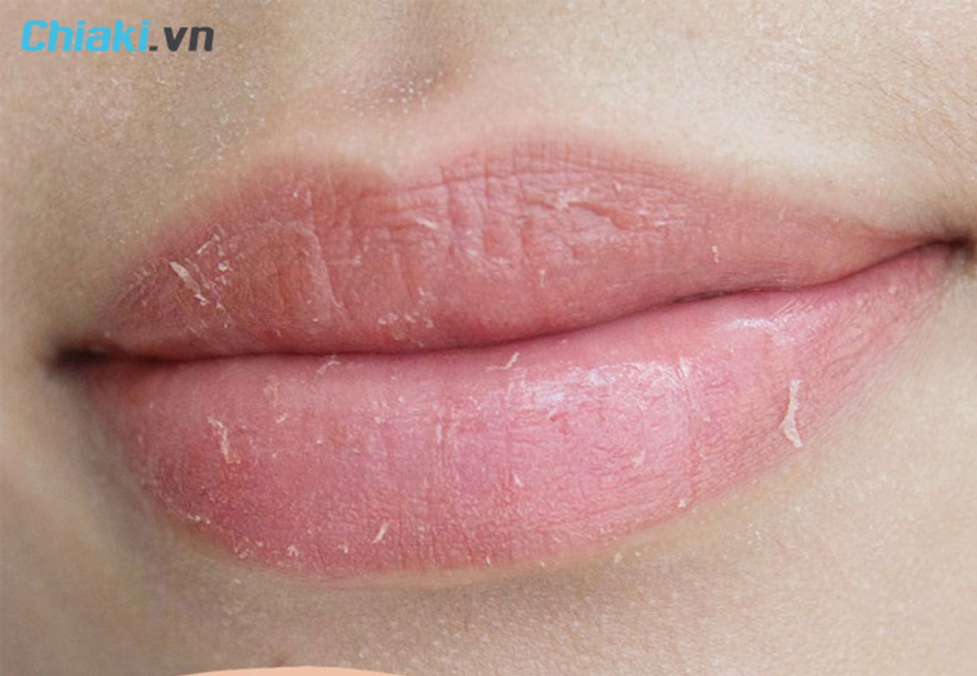 sử dụng son dưỡng m&ocirc;i sau xăm khi m&ocirc;i bong