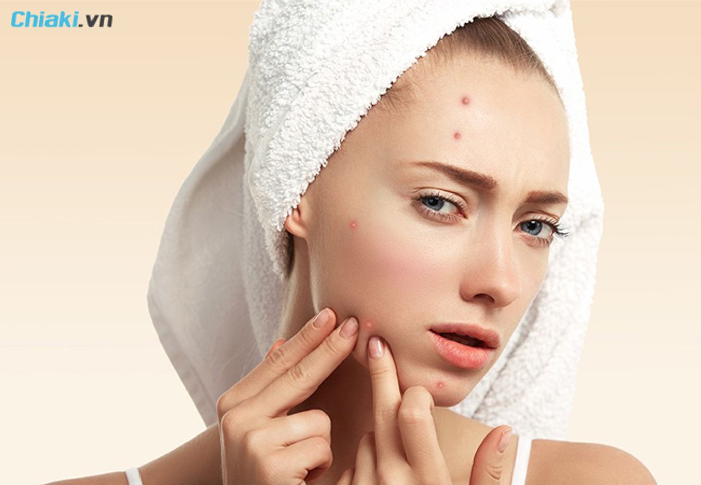 Những điều cần lưu &yacute; khi chăm s&oacute;c da mụn vi&ecirc;m