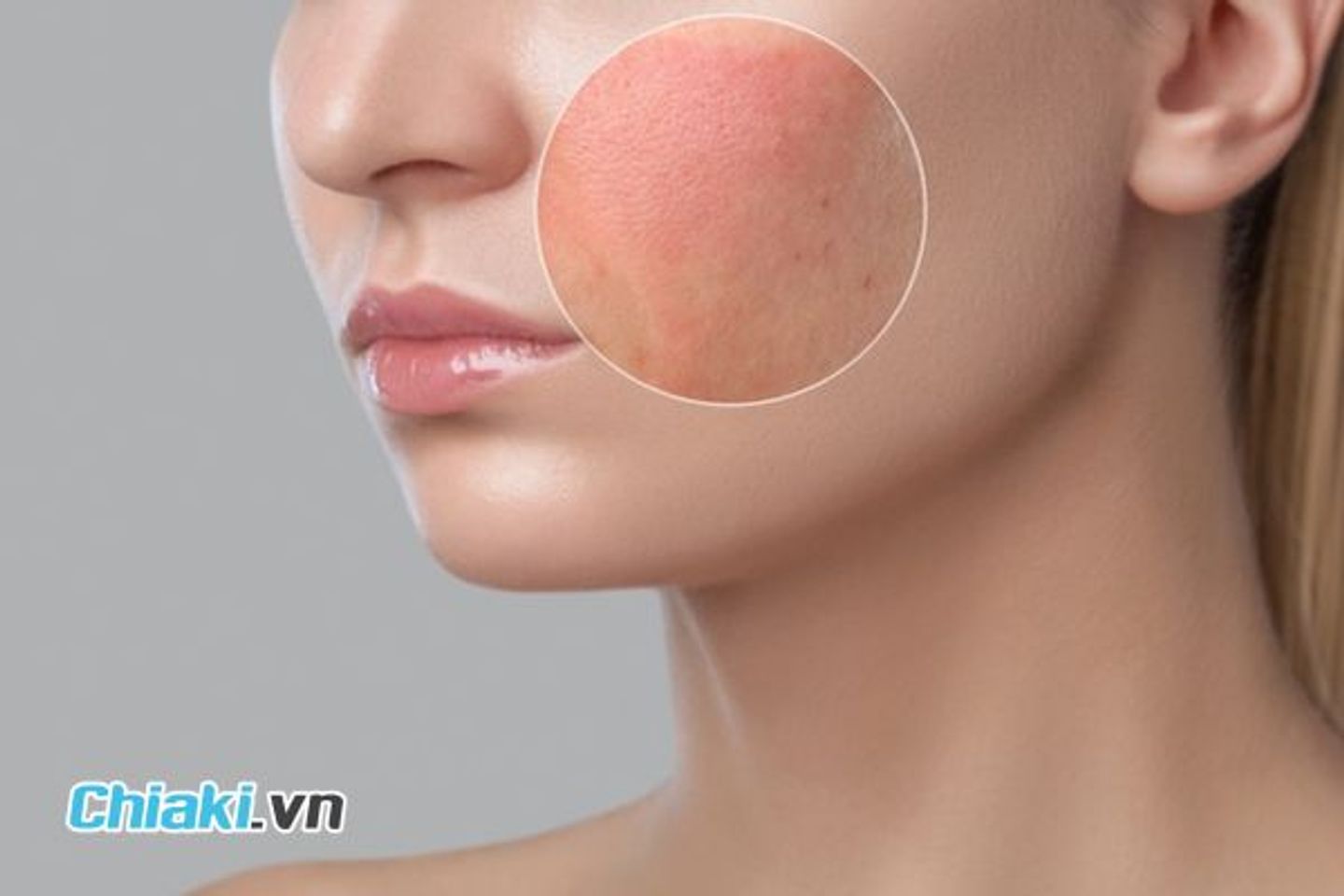 ưu &dstrok;iểm phụ của mặt nạ đất s&eacute;t