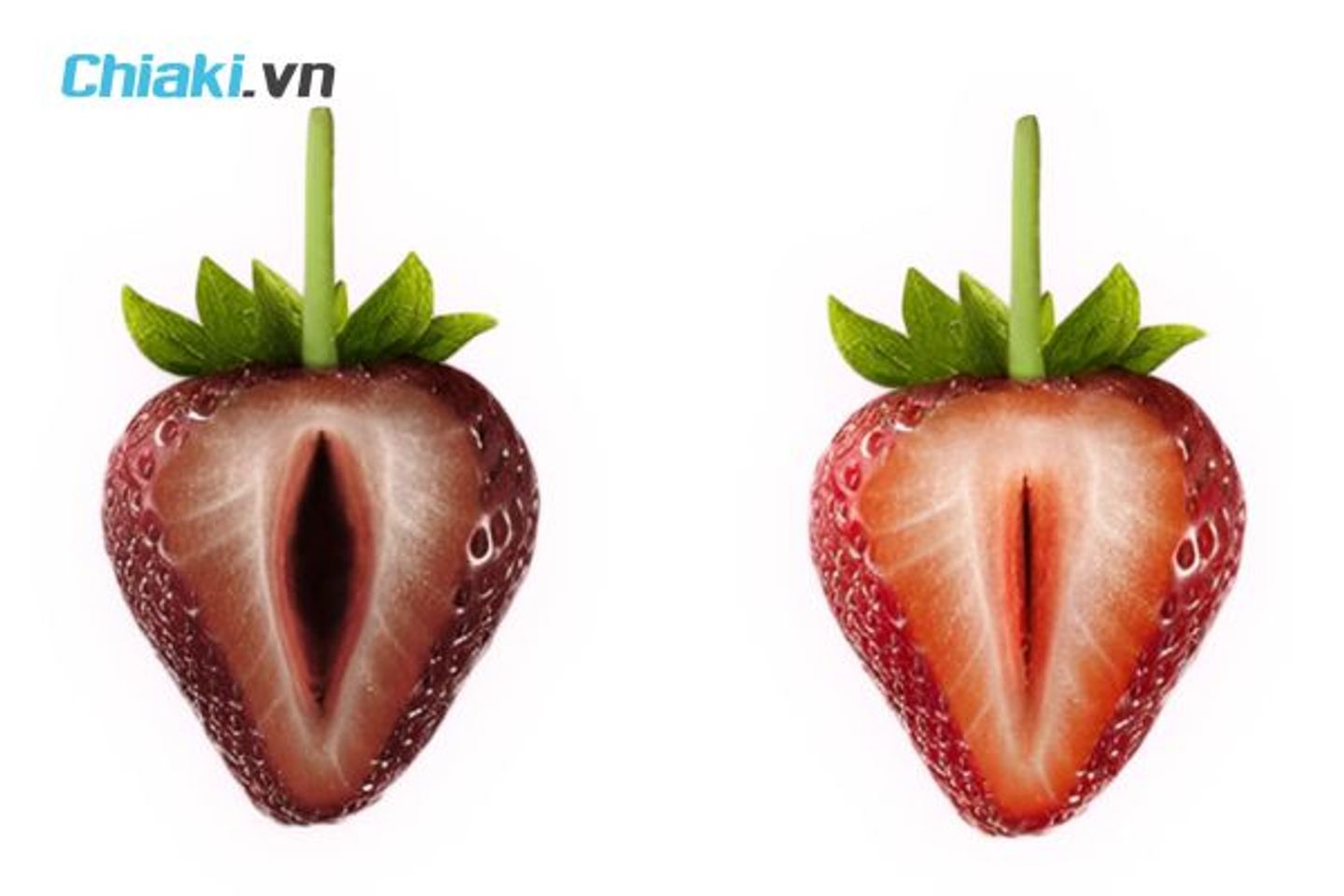 Bị th&acirc;m v&ugrave;ng k&iacute;n do cơ địa, di truyền